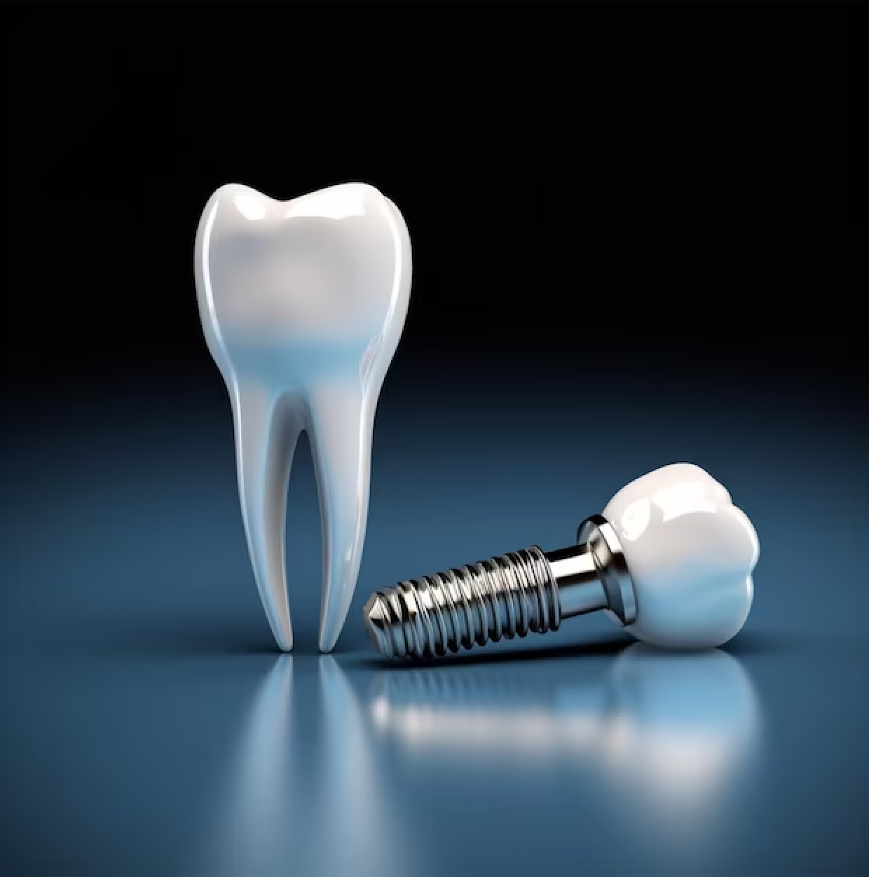 What Are Dental Implants?